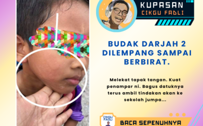 Budak Darjah 2 dilempang Sampai Berbirat.